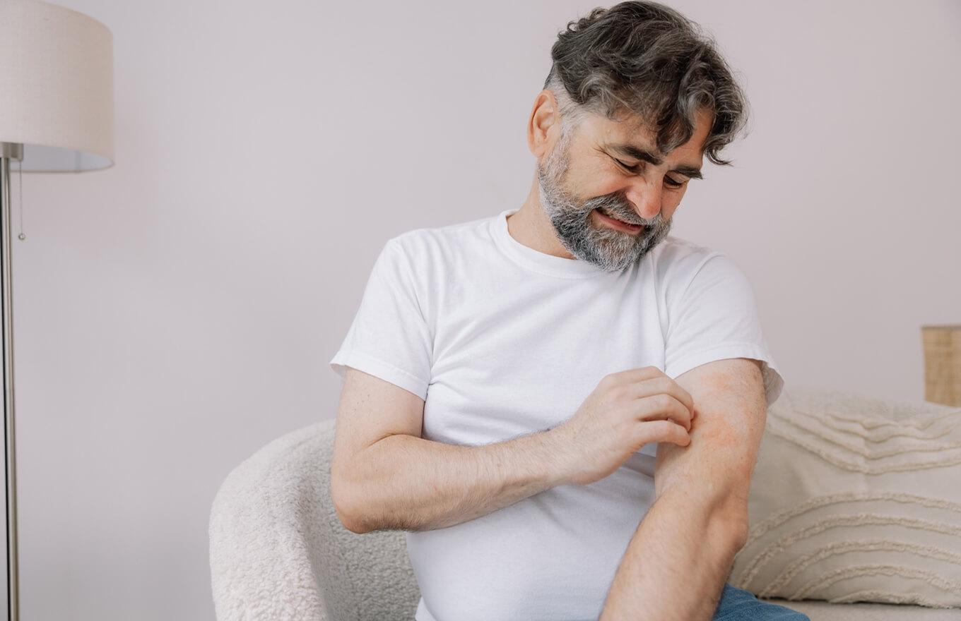 Recepta na atopowe zapalenie skóry